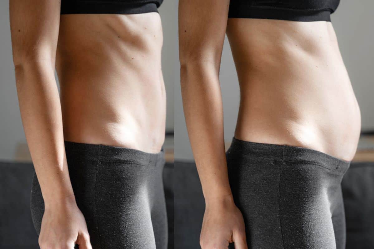 How long does diastasis recti take to improve Thame?