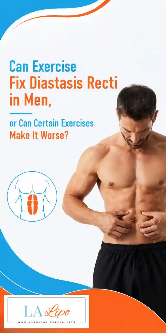 Can Exercise Fix Diastasis Recti in Men, or Can Certain Exercises Make It Worse Thame?